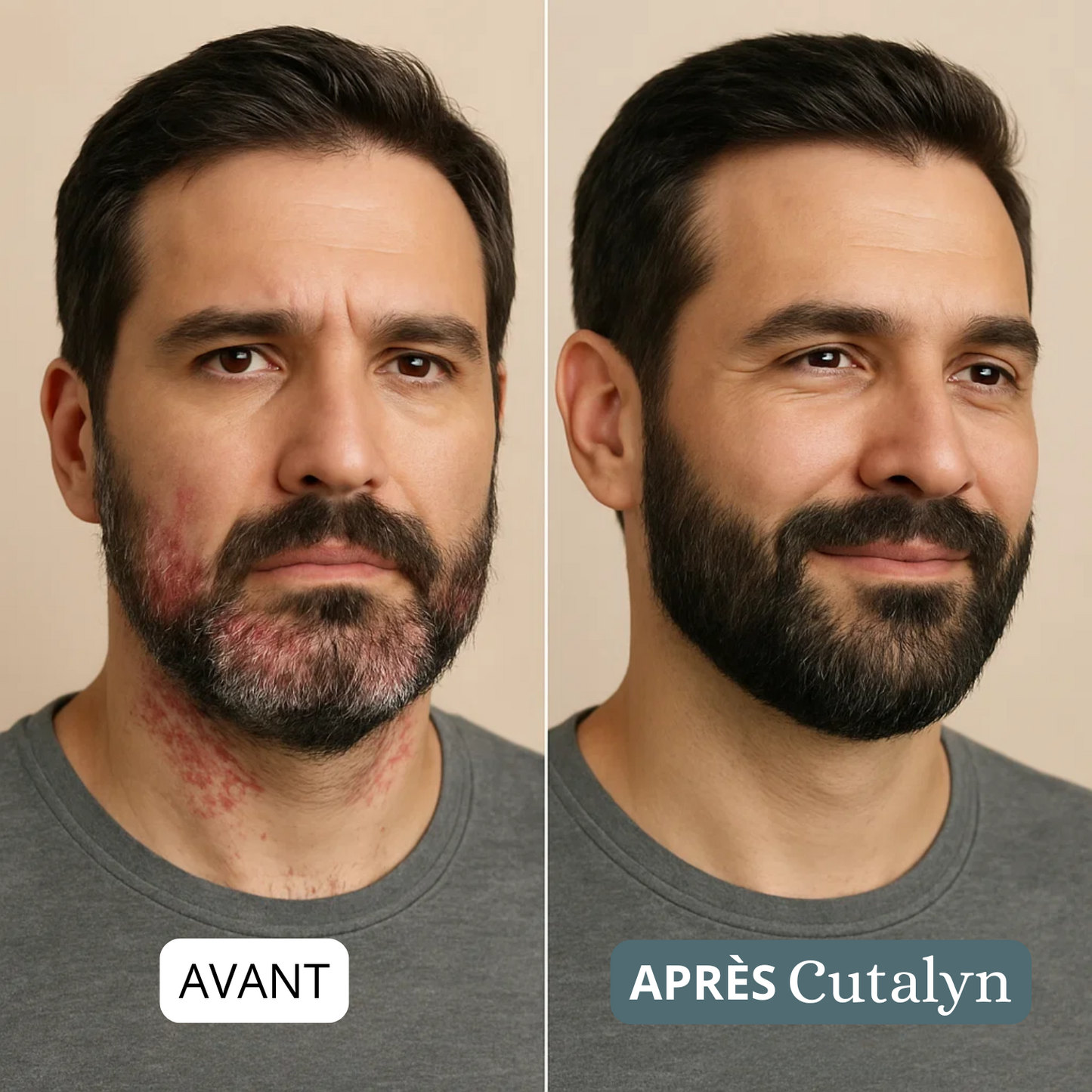 SensiCalm® Duo+ ⎜ Barbe & cuir chevelu apaisés